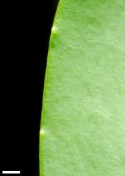 Veronica stricta var. stricta. Leaf margins showing minute hydathode teeth. Scale = 1 mm.
 Image: P.J. Garnock-Jones © P.J. Garnock-Jones CC-BY-NC 3.0 NZ